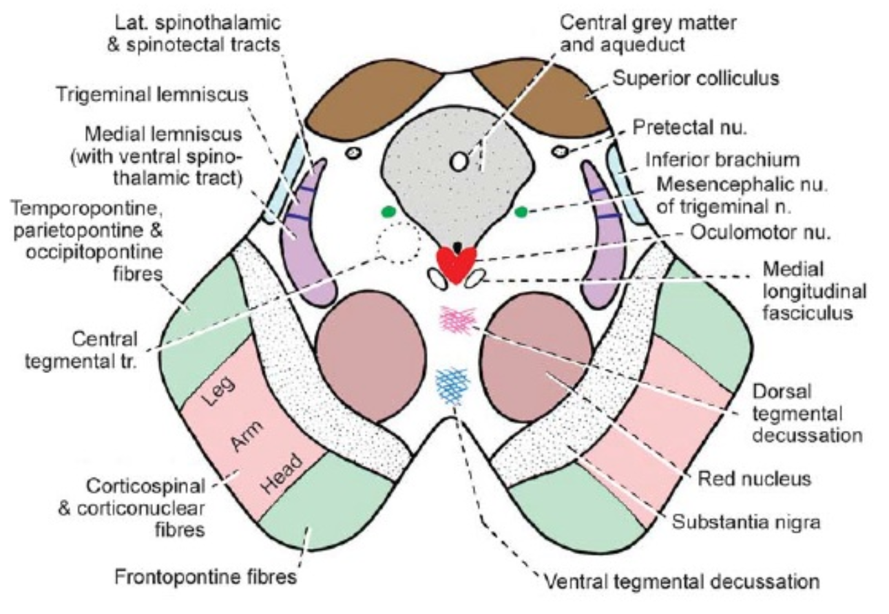 mitthjärna_anatomi_tvär_extra